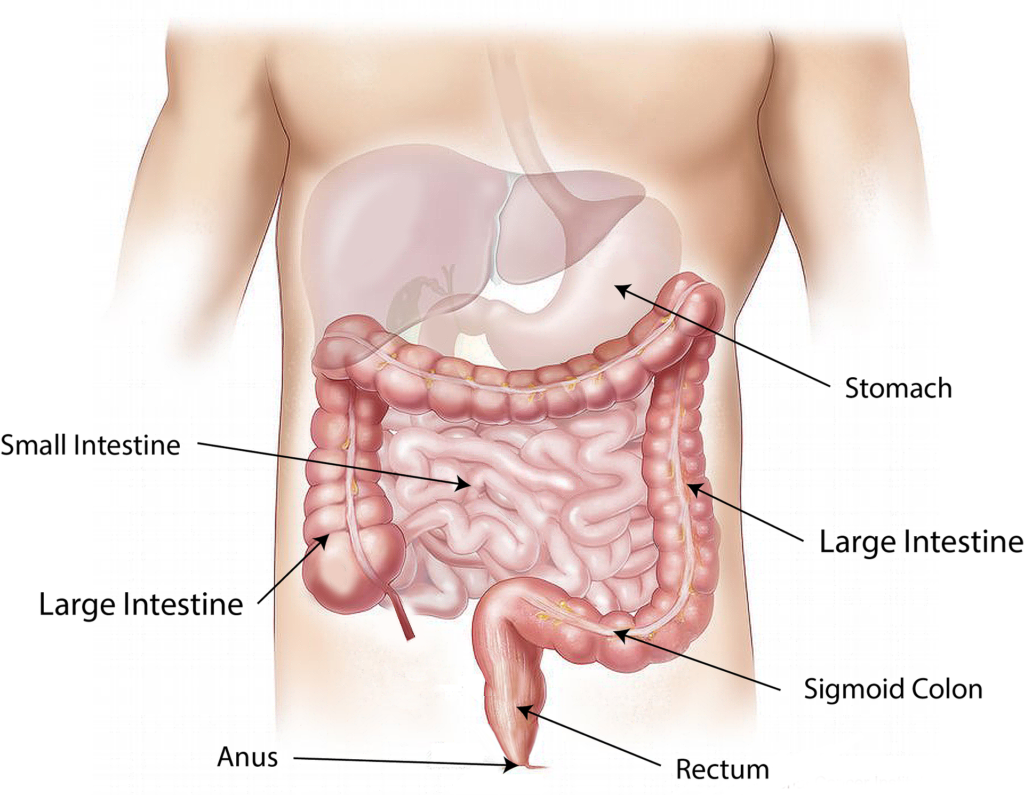 sindrome dell'intestino irritabile, Dieta FODMAP e sindrome dell&#8217;intestino irritabile